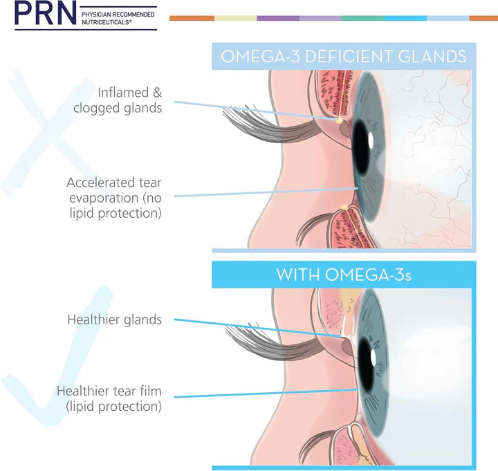 PRN De3 Dry Eye Omega Benefits : Oméga-3 Gels Mous pour l'Œil Sec